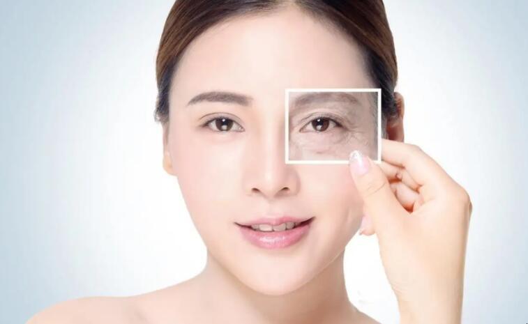 静态鱼尾纹和动态鱼尾纹怎么去除,什么是鱼尾纹法令纹抬头纹