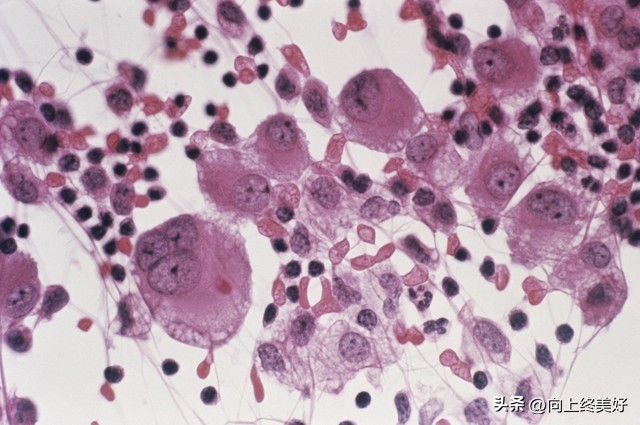 为什么不建议学基础医学,基础医学研究生能当医生吗