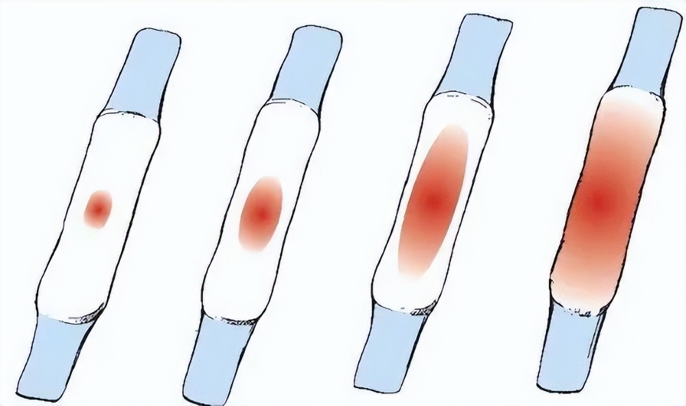 女生生完孩子性冷淡风怎么治,生完宝宝性冷淡风如何调理