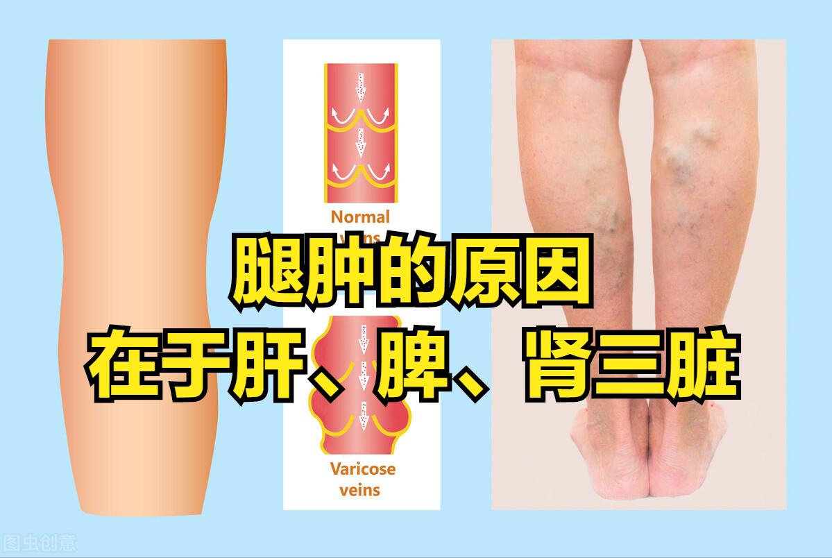 身体浮肿的偏方,身体浮肿中医怎么调理