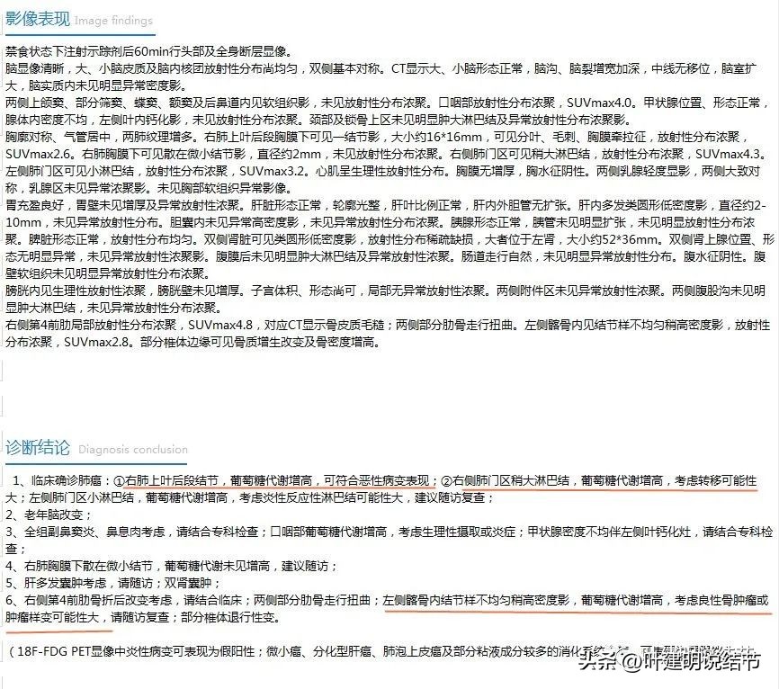 79岁肺癌早期手术风险,75岁早期浸润性肺癌还要治疗吗