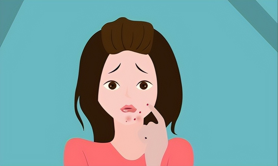 挤痘痘后有痘印怎么办,满背痘痘和痘印怎么办