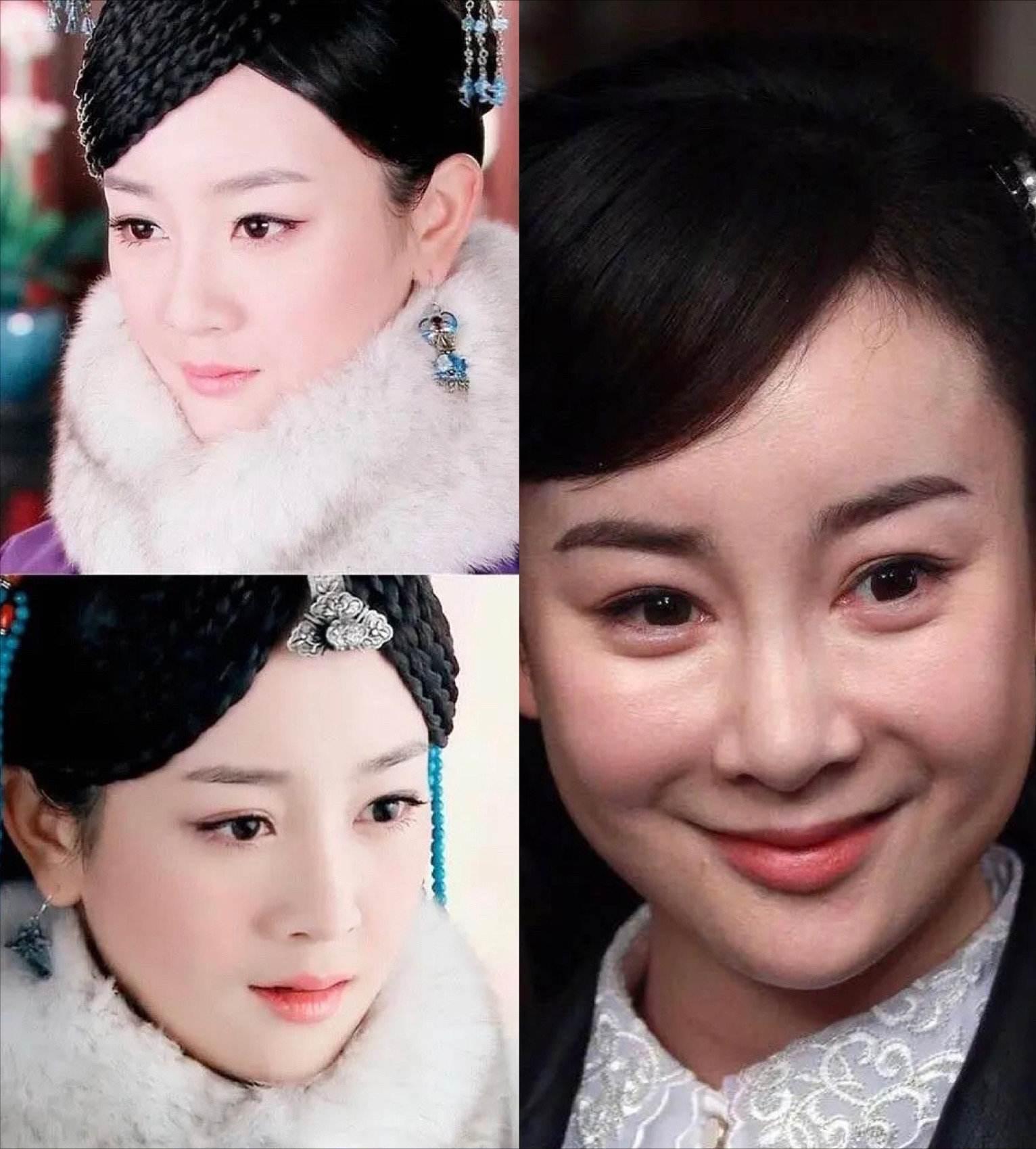 最失败硅胶脸的女星,硅胶脸女明星排行