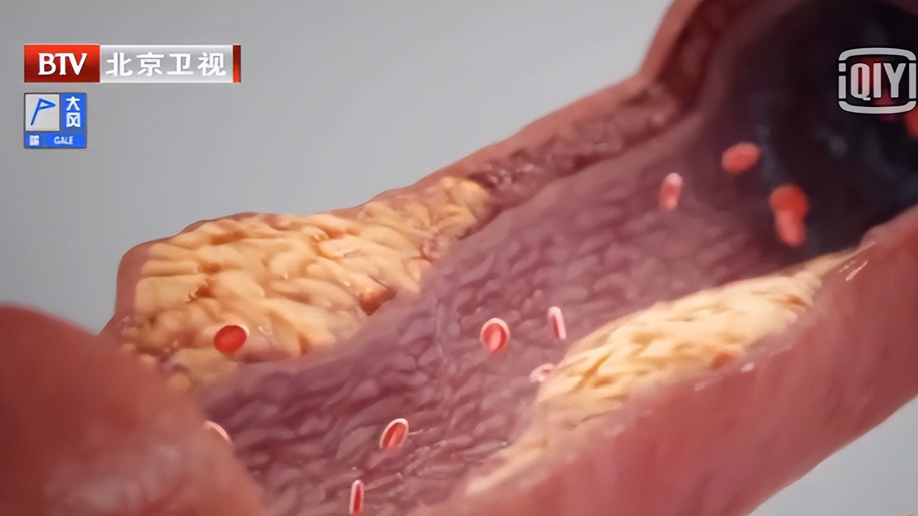 生气会导致身体有哪些症状,生气对身体的七大危害