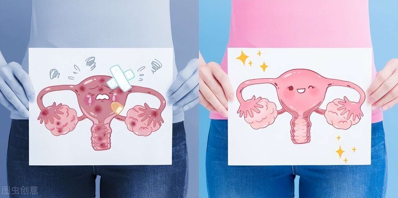 女子体检过程中，发现子宫内有毛发和黏稠物，与什么哪些原因有关