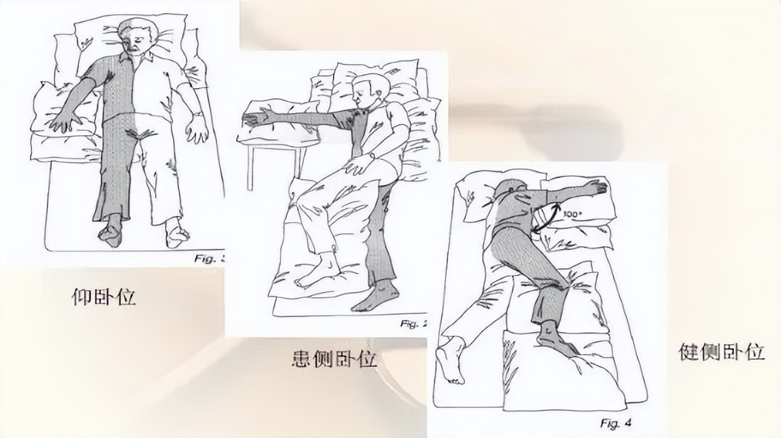 脑梗康复训练过程中注意事项,脑梗后的康复训练方法