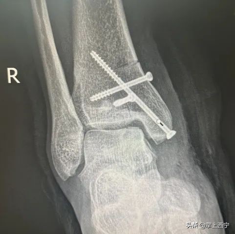 西宁市第三人民医院外科,西宁第三人民医院扩建项目