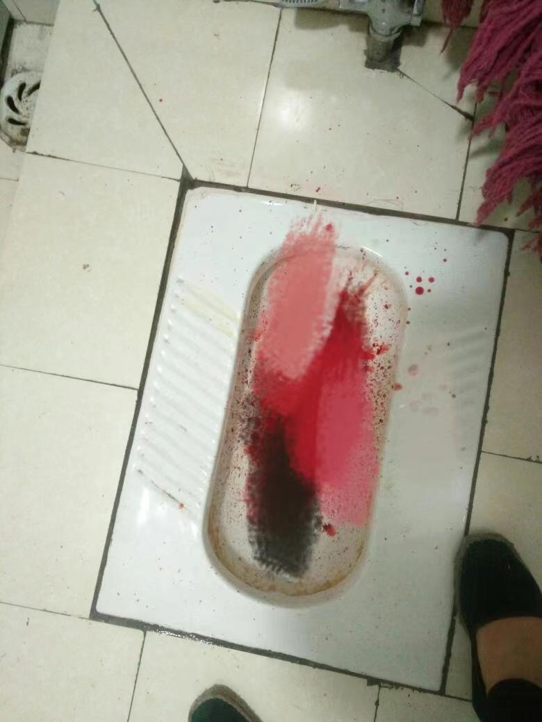 杭州少女大出血,杭州25岁女孩突然大出血