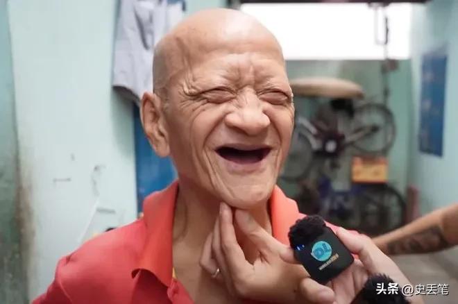 越南有位大爷从出生开始就浑身无毛，女友去世后他选择终身不娶