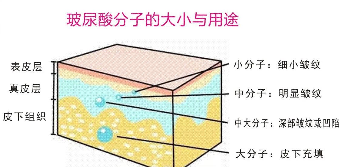 为什么嘴巴的玻尿酸吸收得很快,如何判断是真的玻尿酸