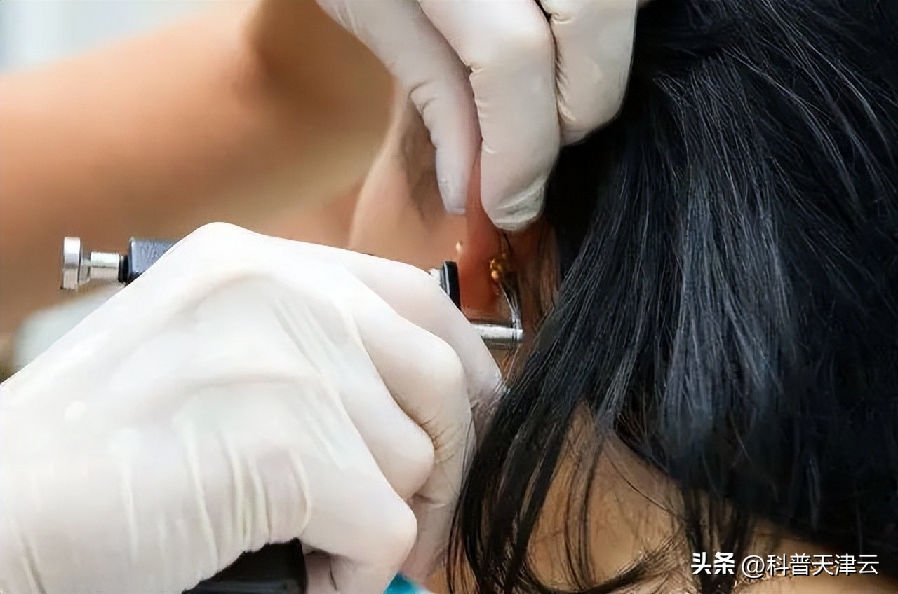 冬季打耳洞有什么注意事项,耳洞小打耳洞有什么忌讳