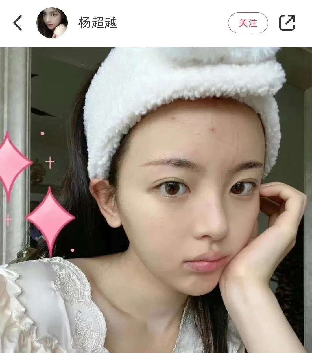 垫屁垫，烤瓷牙，戴美瞳：这些女明星的修修补补，看得人眼花缭乱