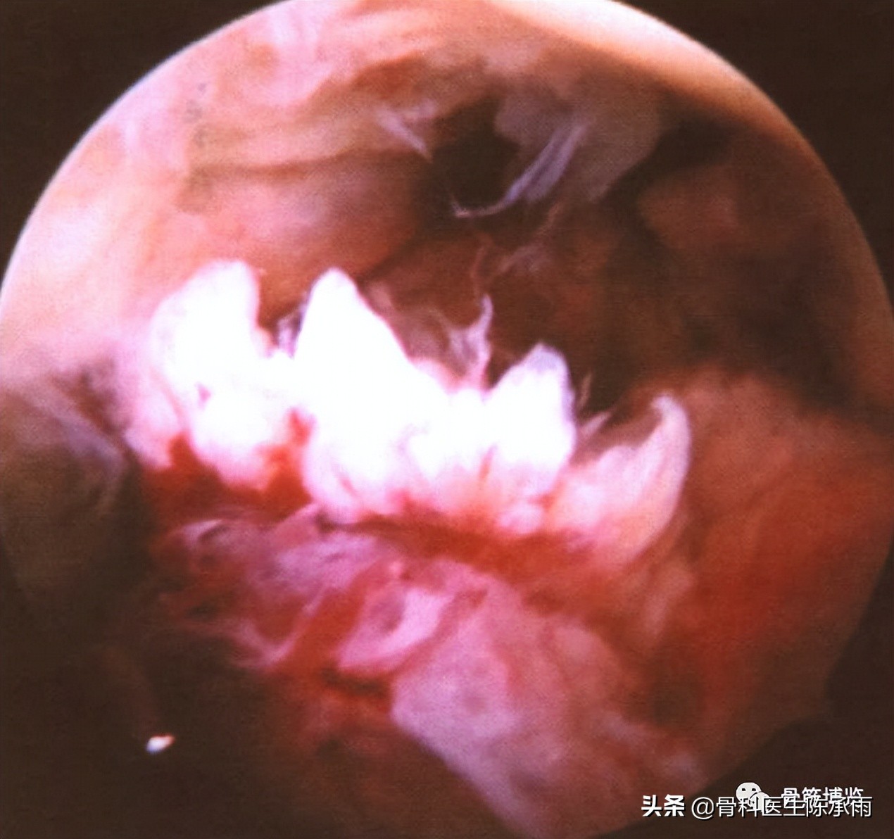 膝关节2度损伤需要做关节镜吗,膝关节常见损伤的检查方法