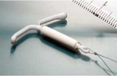 是结扎还是上环?二者差距有点大,哪个对女性的伤害更小