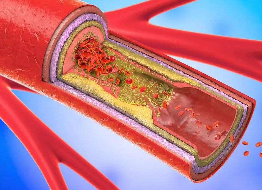 每天久站8小时对身体有什么影响,每天久坐8个小时以上的危害