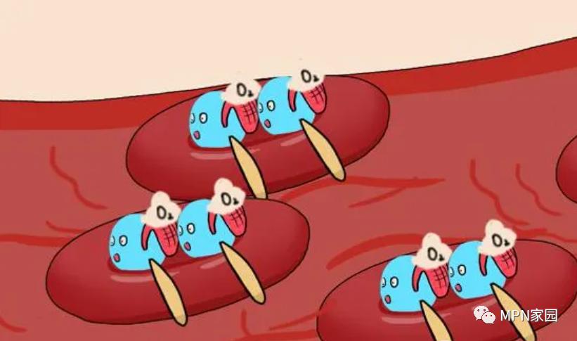 真性红细胞增多症（PV）患者如何进行日常的“疾病管理”？