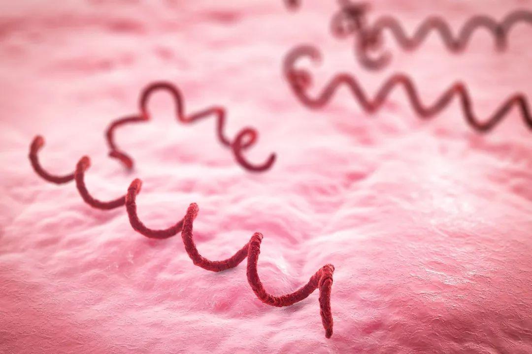 得了梅毒有什么症状？身上会痒吗？梅毒可以治愈吗？建议了解一下