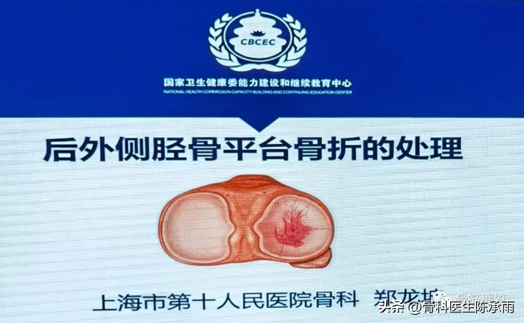 国家卫健委主办的骨创伤专项能力培训项目----下肢损伤学习班