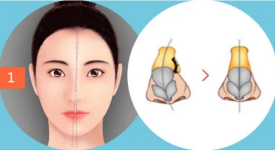 陈国成最近视频,陈国成视频