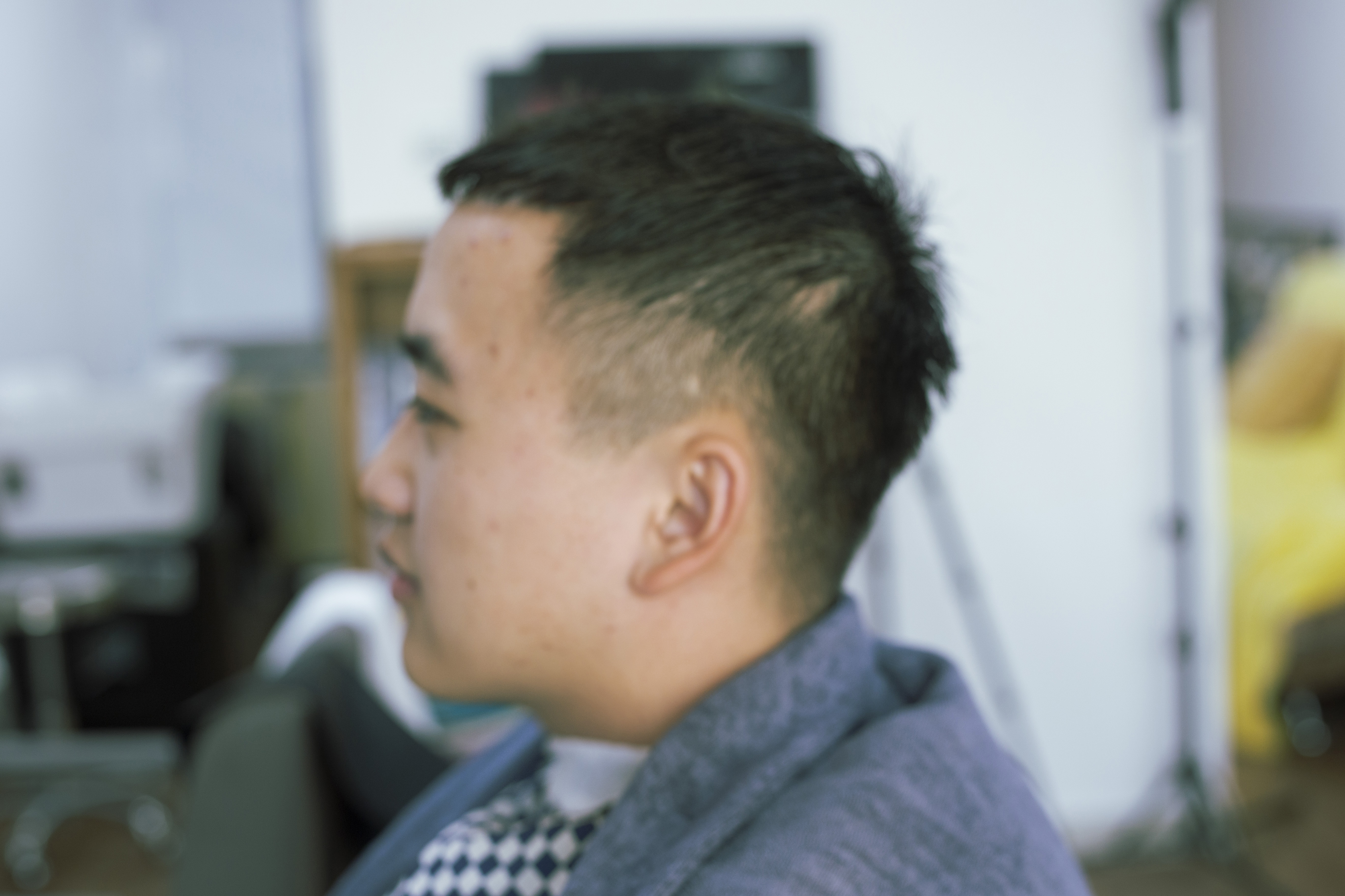 高发际线发量稀疏发型,发际线高头发稀疏掉头发怎么拯救