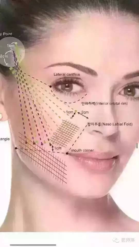 消除法令纹的正确方法是什么呢,有法令纹怎么办简单又实用的方法