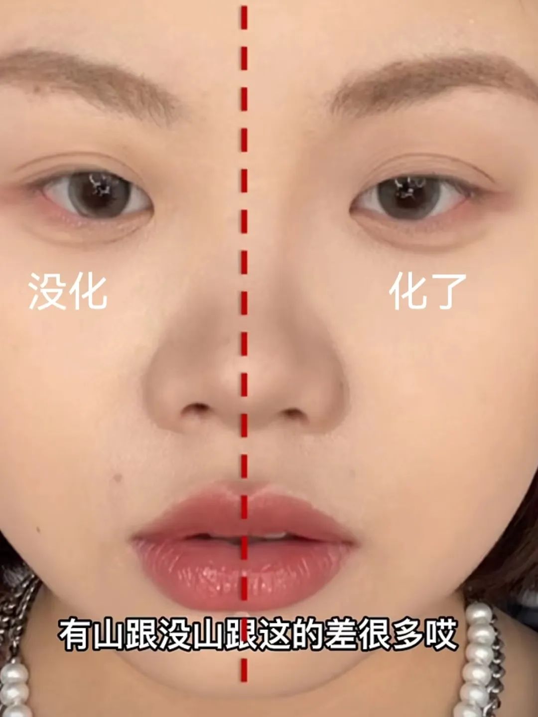 塌鼻子正脸好看,塌鼻子该如何变美啊