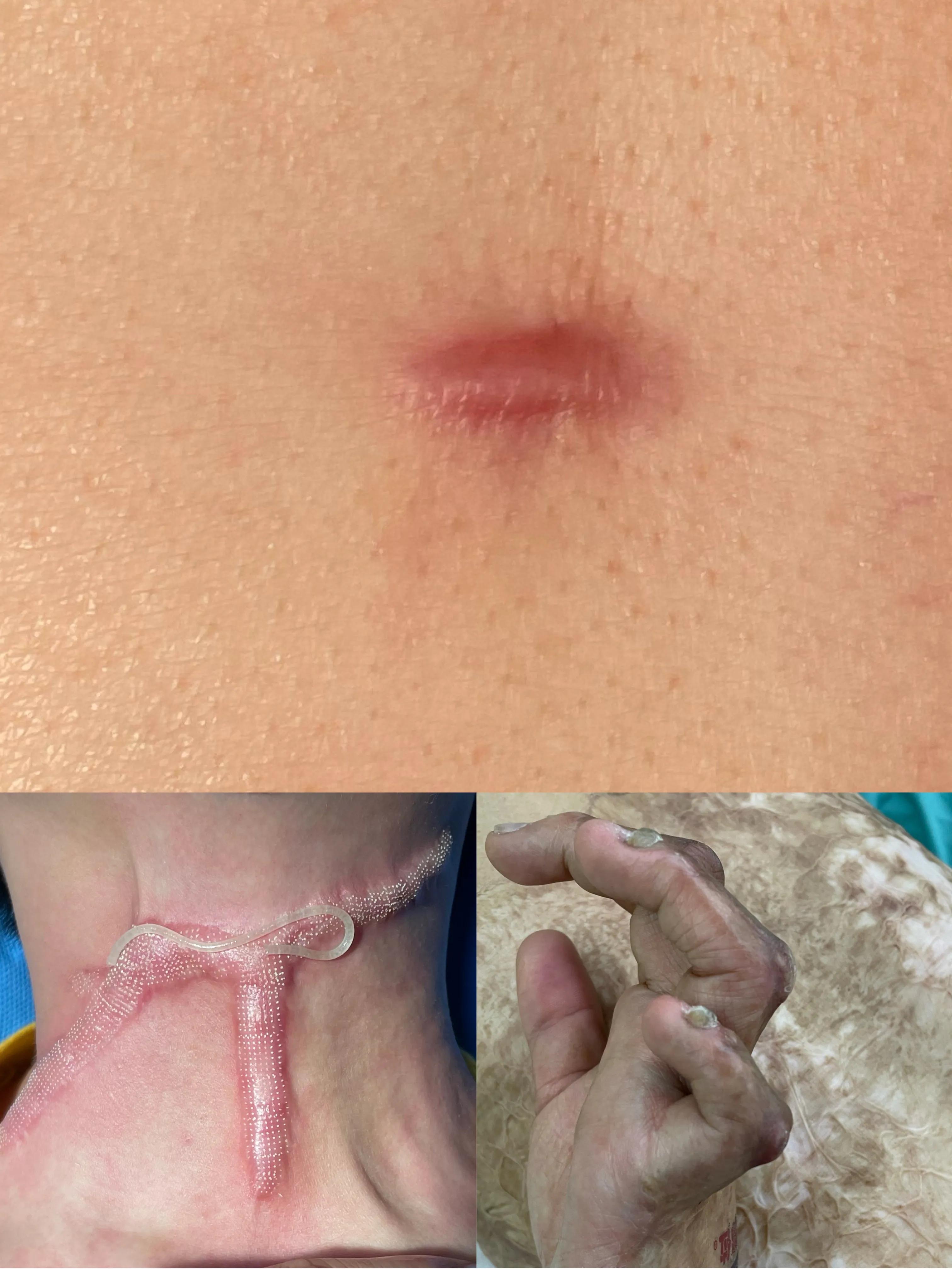 身上有疤痕吗三分钟了解祛疤方法,身上有疤痕医院怎么去除