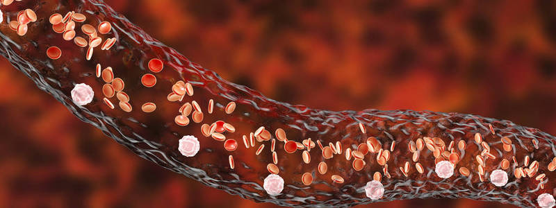 阴虚火旺手冰凉,阴虚手脚冰凉