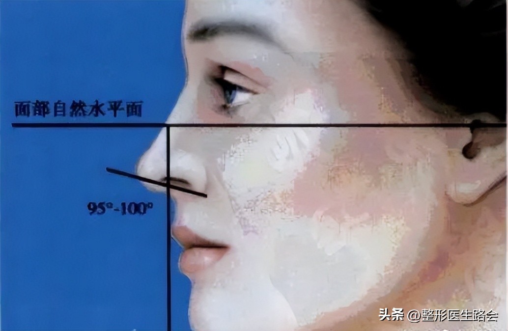 鼻部美学四个关键角度,鼻部美学标准图解