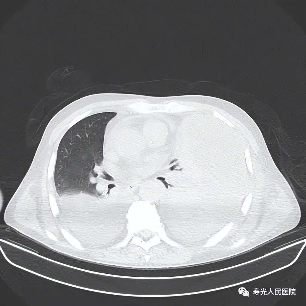 寿光人民医院呼吸与危重症一科,寿光人民医院住院的视频