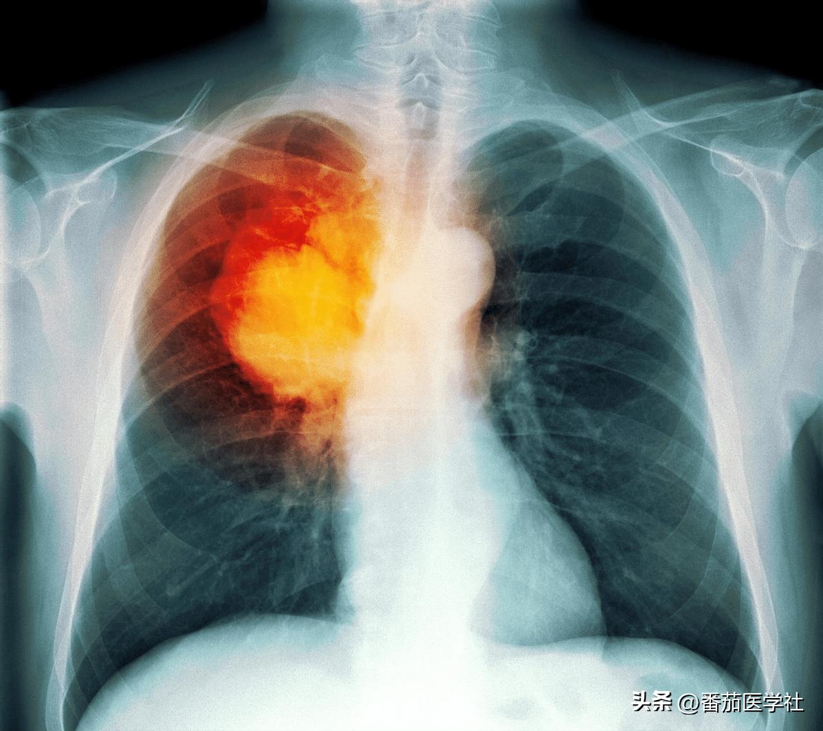 用什么东西可以做伟哥,民间制伟哥用什么