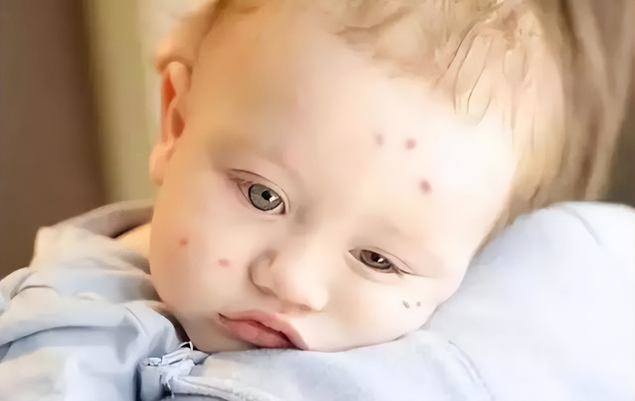 蚊子最怕的3个小妙招,快速让蚊子消失这小技巧