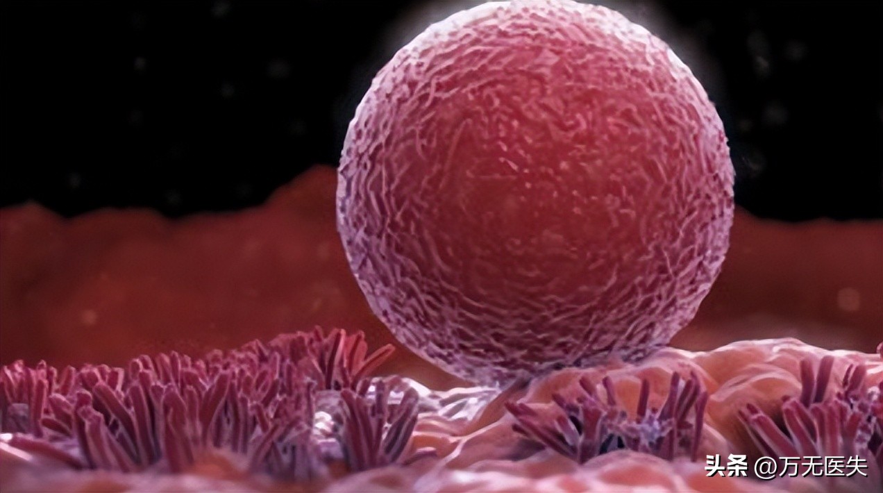 那些进入女性体内，没有成功“受精”的精子，最后都怎样了？