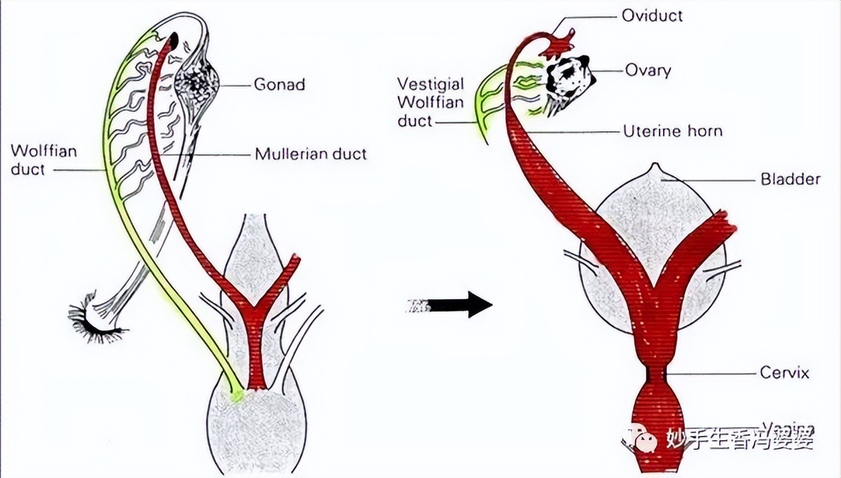 子宫畸形造成的胎停好治疗吗,子宫畸形是不是没法生孩子了