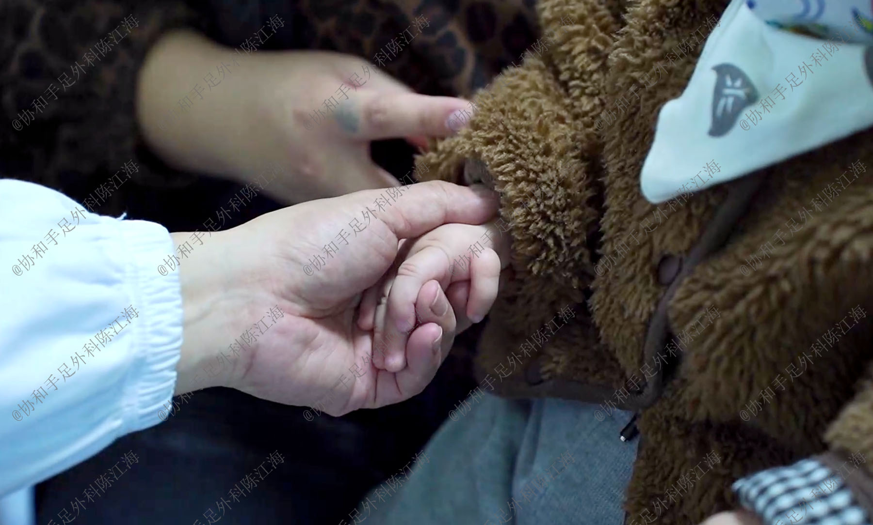 漂浮趾的治疗,拇指漂浮指的治疗方案