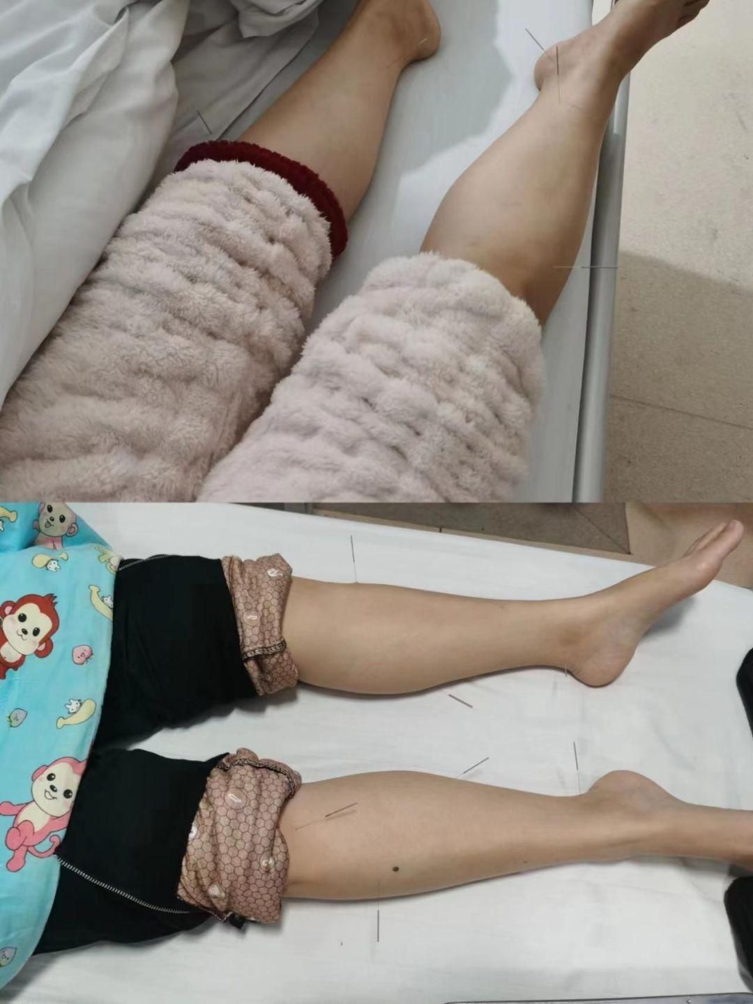 化疗后手脚麻中医中药来缓解