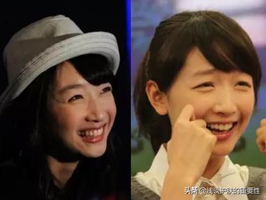 去掉眼纹会不会更显年轻,有眼纹和眼袋哪个更显老