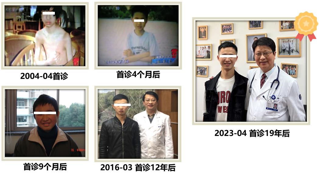 沈华浩胸闷变异性哮喘,胸闷变异性哮喘治疗的最佳方法