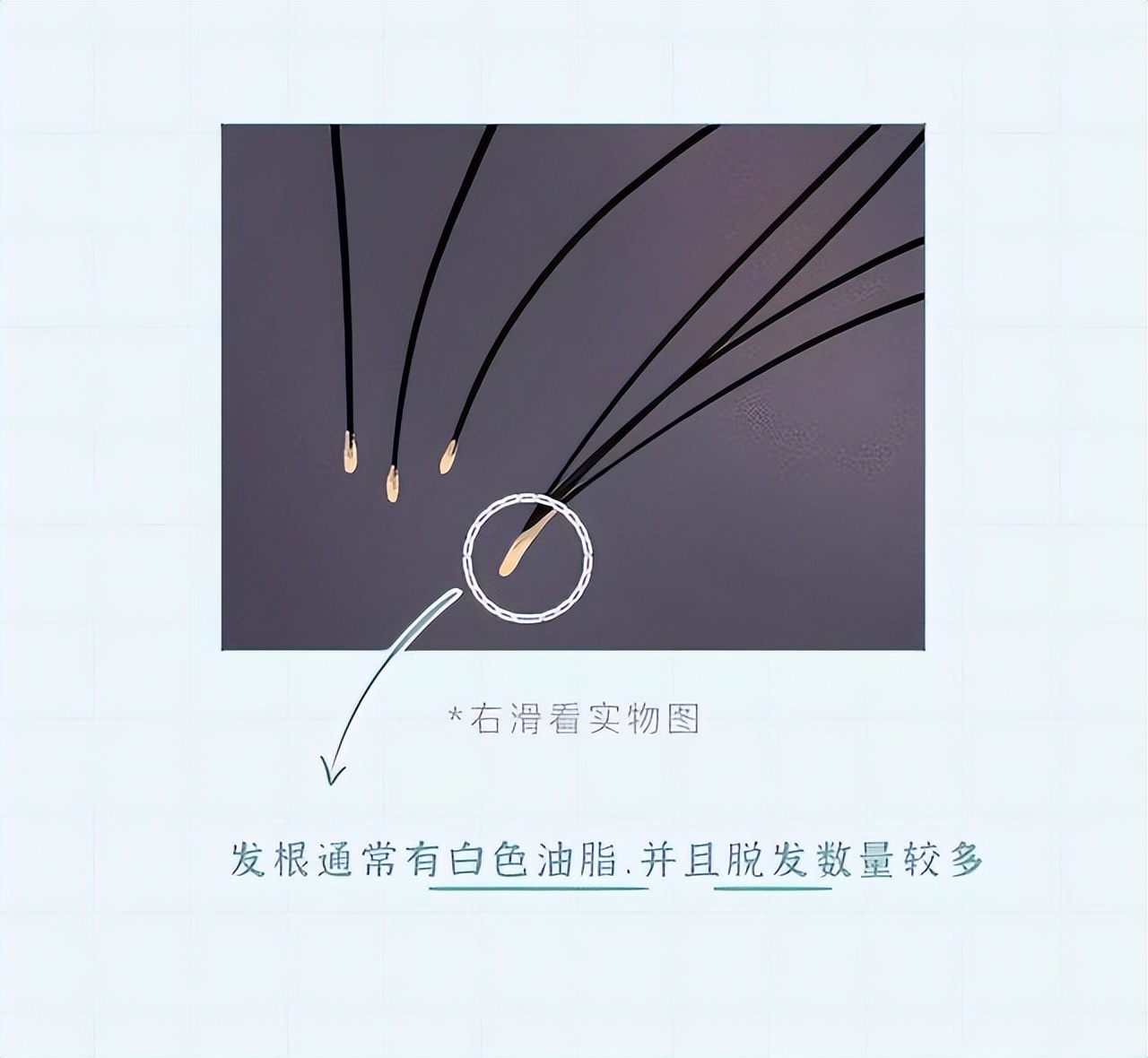 头皮上白色的颗粒是什么问题,头皮屑多是什么原因漫画