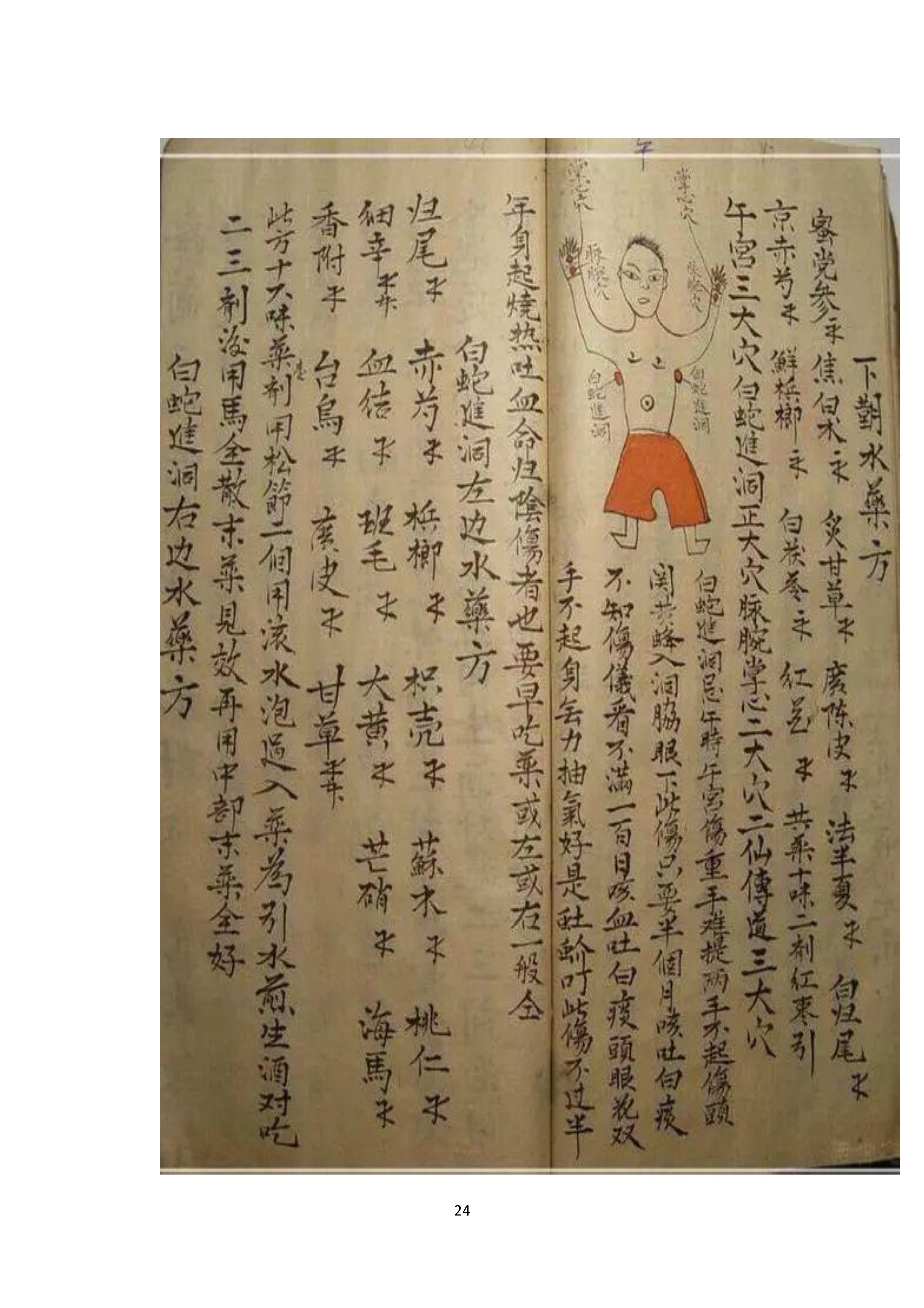 中医古书籍清代带图且内容非常好的手抄跌打损伤良方