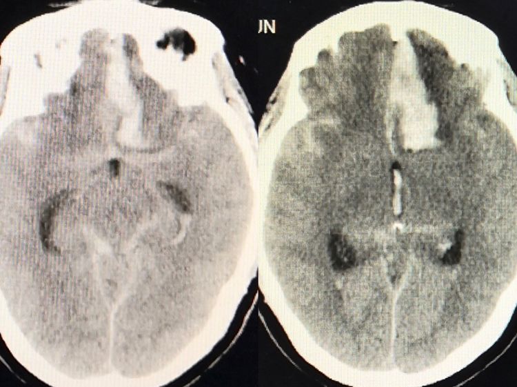 一个值得唠叨几句的病例