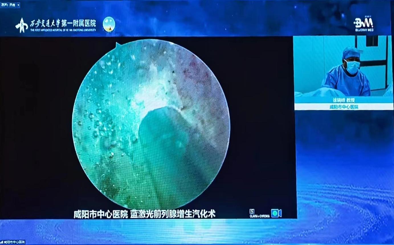 国产蓝光激光器应用,蓝激光扫描仪器