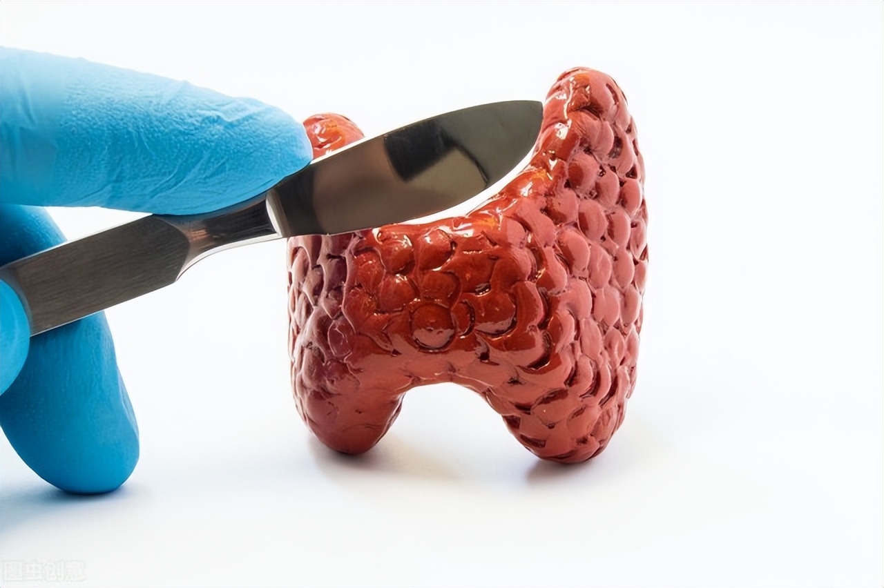 甲亢心脏病治疗,治疗甲亢的穴位