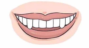 牙满分,牙满分怎么样