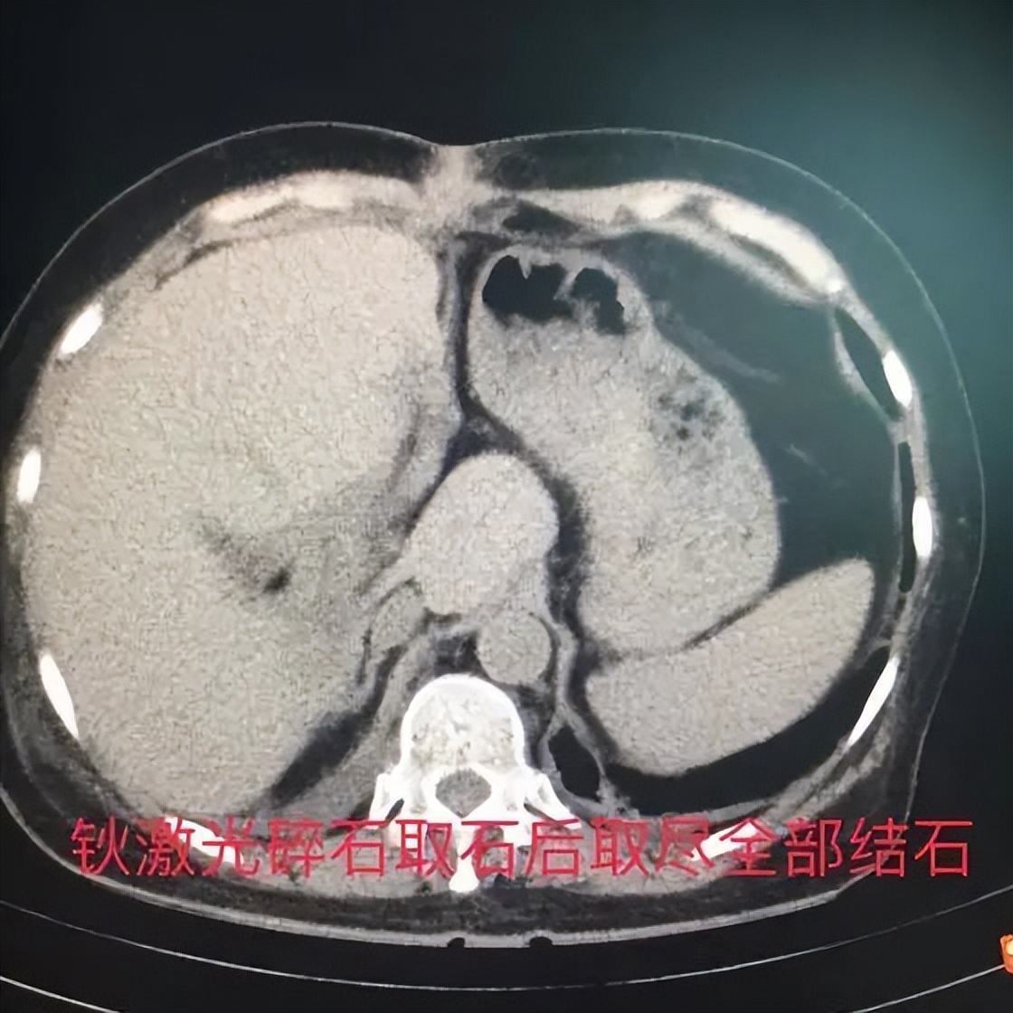 医患故事七面锦旗述说生命奇迹,医院锦旗故事