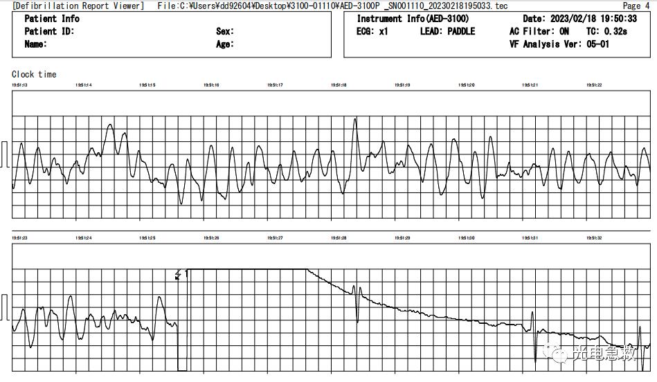 足球感人瞬间心脏发生骤停,2004足球运动员心脏骤停事件