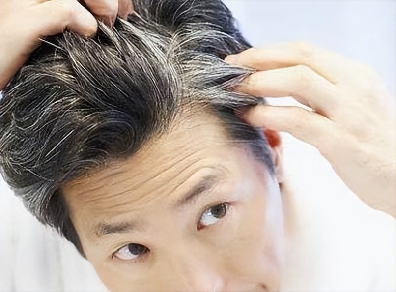 白头发越长越多缺什么营养,改善白头发生长有哪些营养素