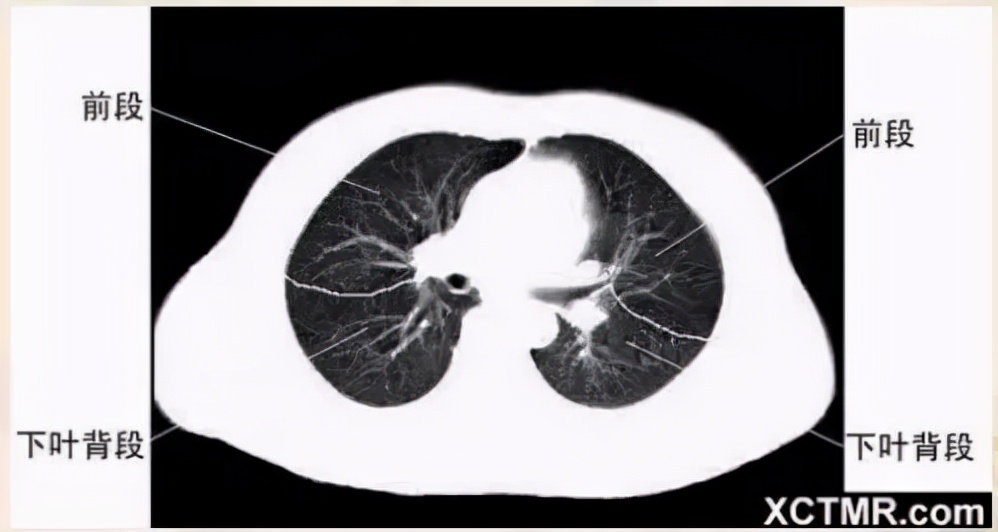 胸腹部盆腔ct主要检查什么,女性盆腔ct断层解剖结构图