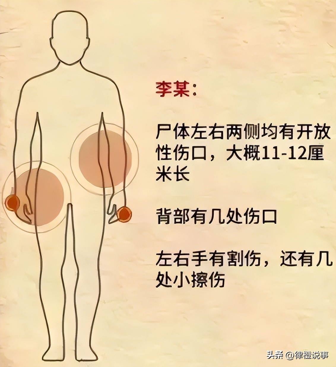 巴厘岛中国情侣遇害案：印尼警方称其为自杀，但细节越挖越蹊跷