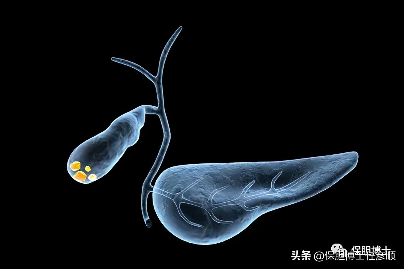 胆囊壁胆固醇结晶能不能喝蛋白粉,什么是胆囊壁胆固醇沉积